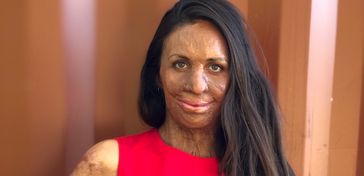 Turia Pitt